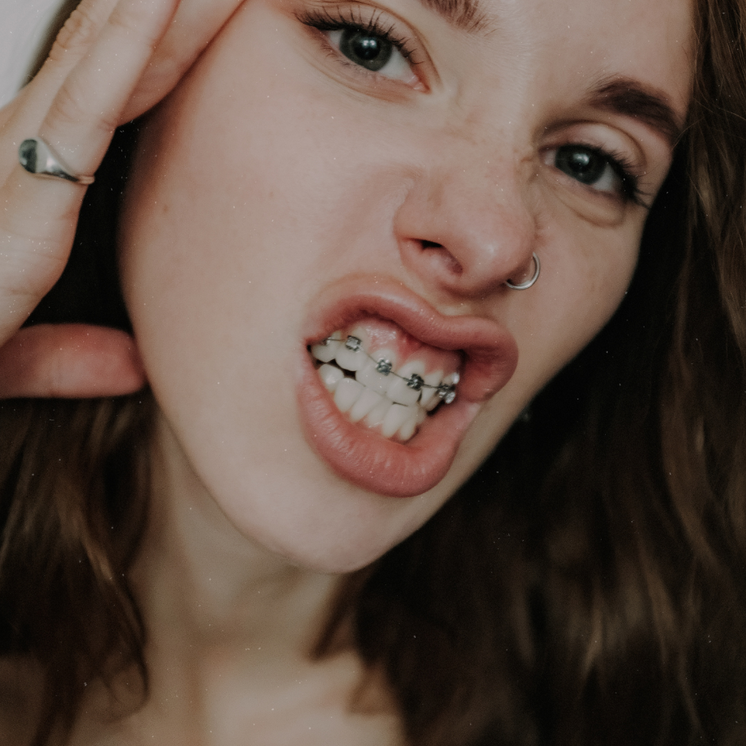 A girl with braces, smiling